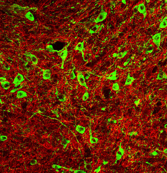 Green dopamine neurons within the red circuitry of the reward center.