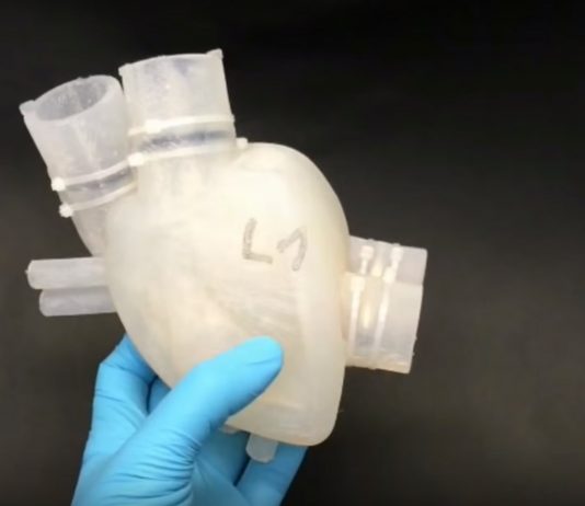 3d printed artificial heart